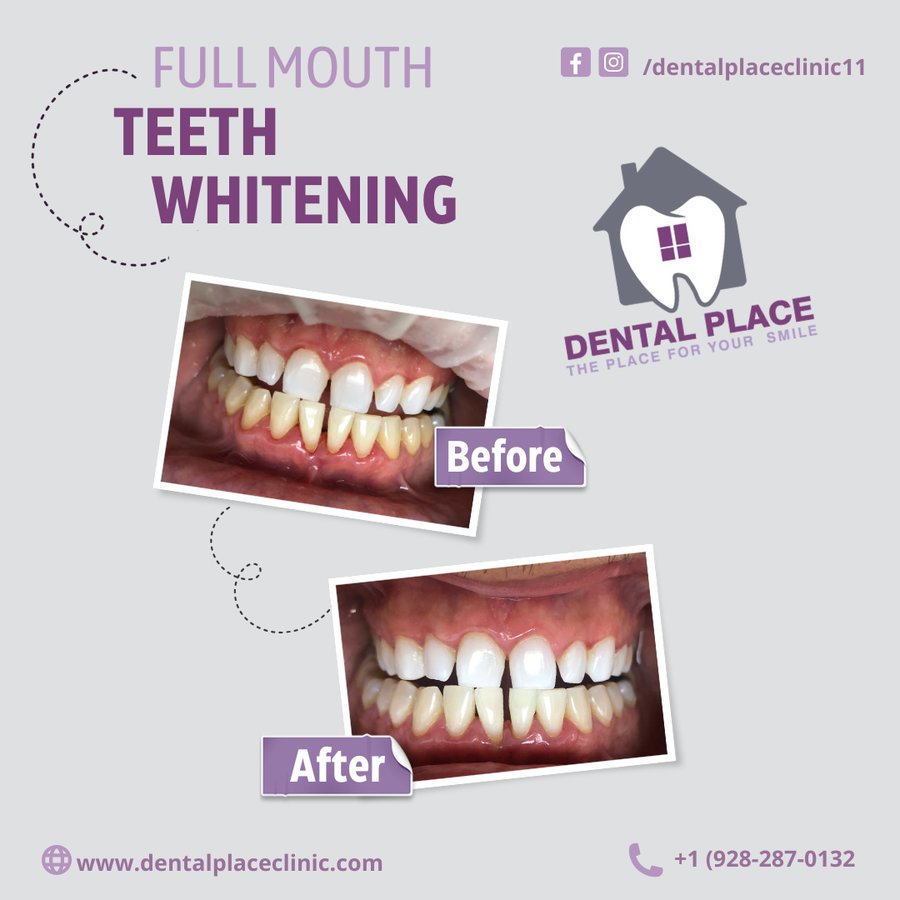 مكان طب الأسنان - DENTAL PLACE